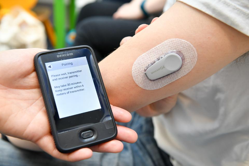Dexcom's Glucose Monitoring Wearable System Receives CE Mark in the Europe