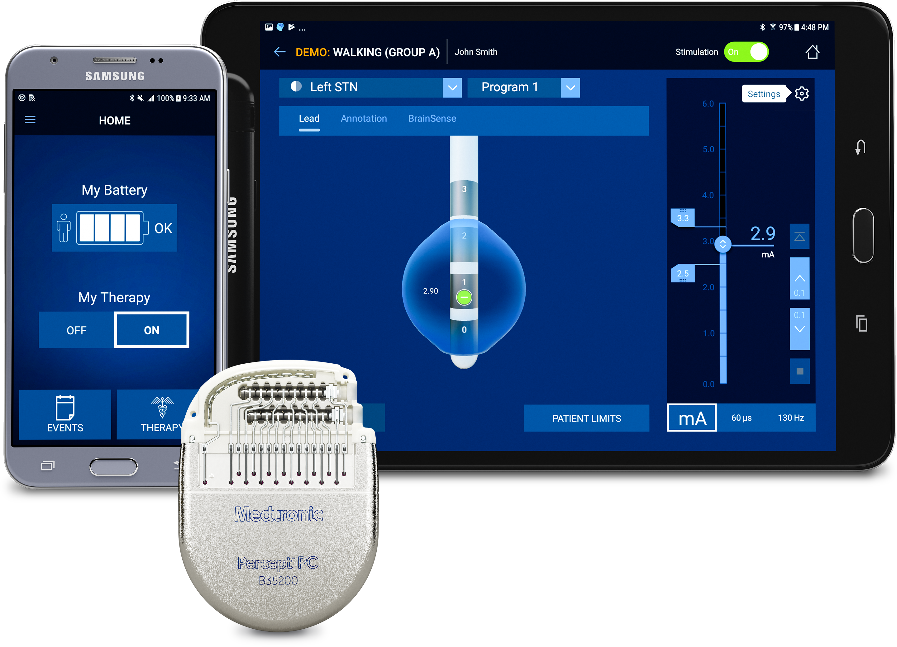 Medtronic Receives the US FDA's Approval for its Percept PC Neurostimulator with BrainSense Technology