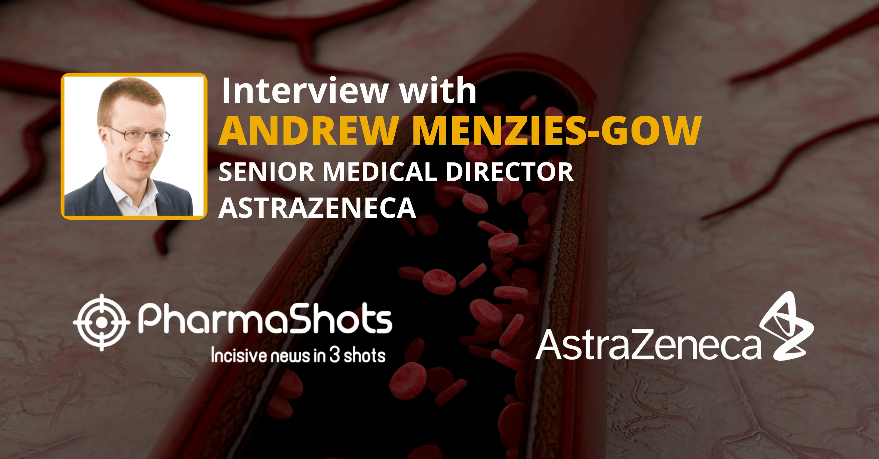 AstraZeneca at ATS’24: Andrew Menzies-Gow from AstraZeneca in a Stimulating Conversation with PharmaShots