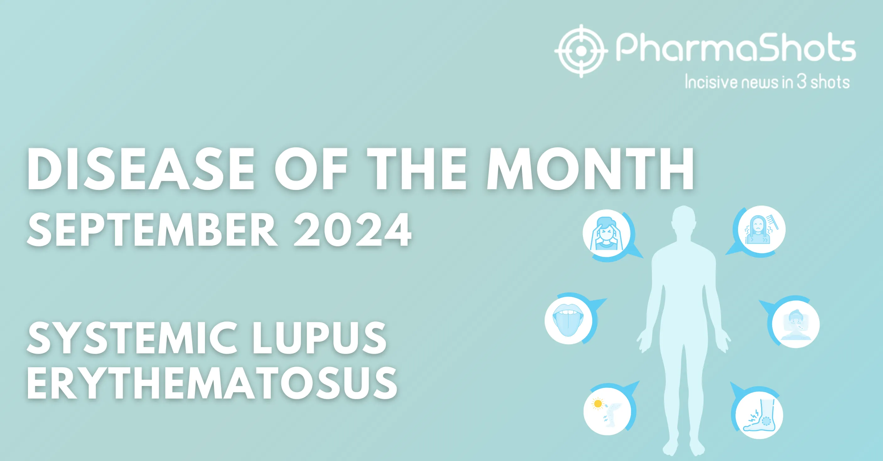 Disease of the Month – Systemic Lupus Erythematosus