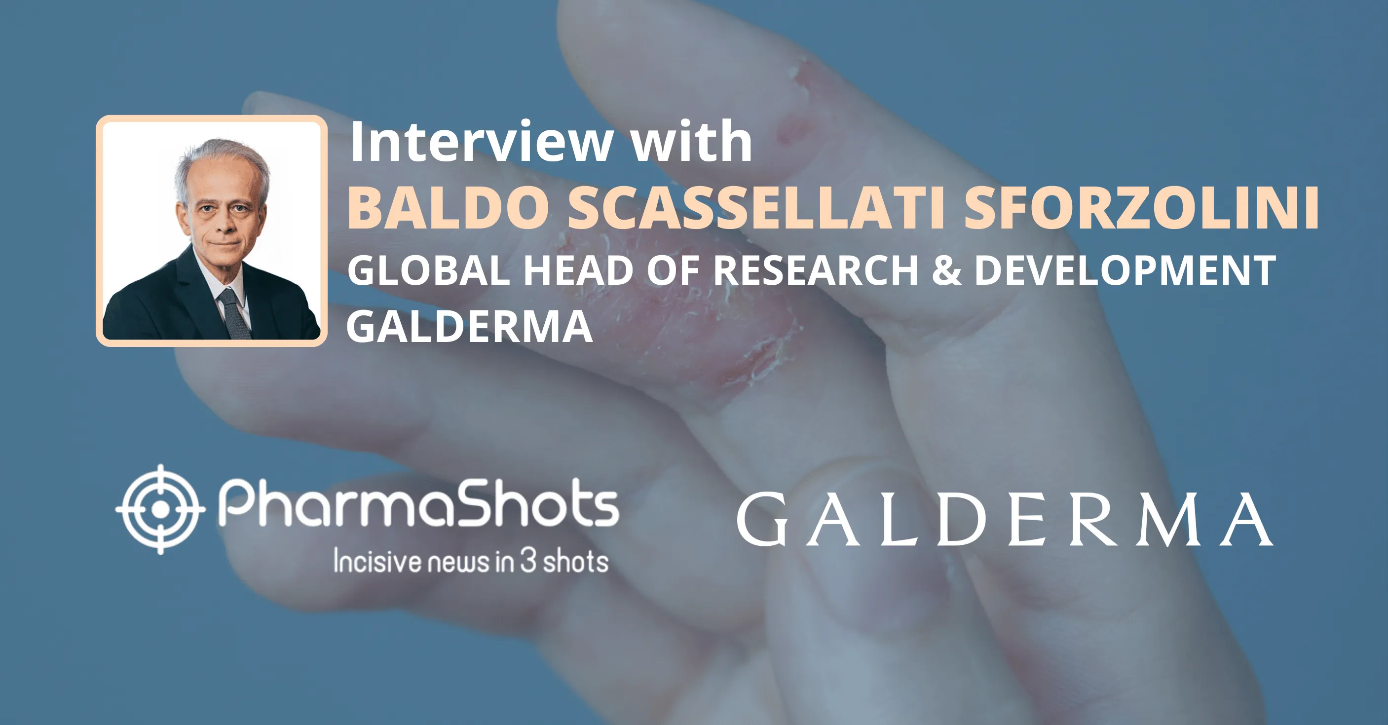 Unlocking Approval: Baldo Scassellati Sforzolini from Galderma in a Stimulating Dialogue Exchange with PharmaShots