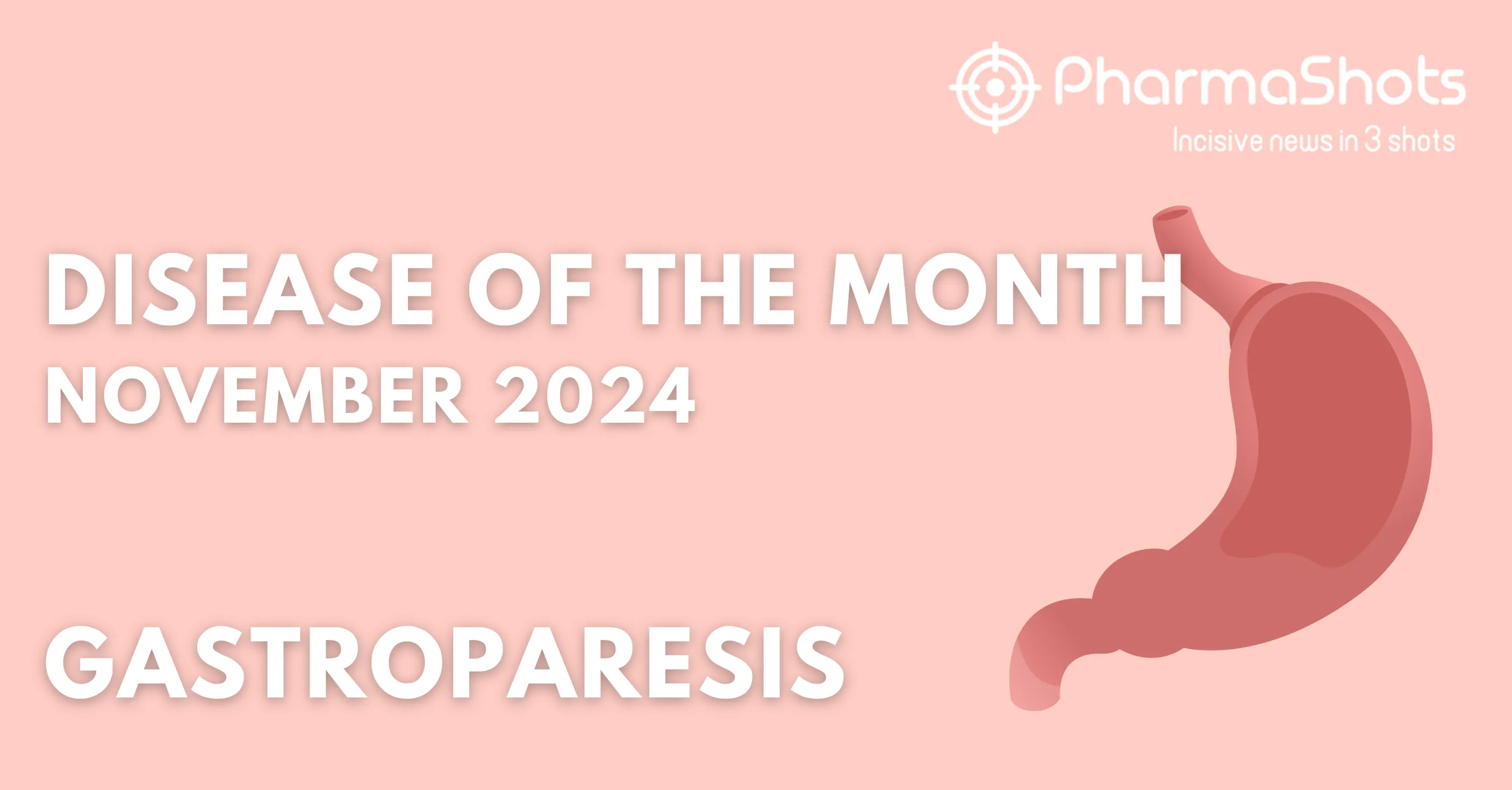 Disease of the Month – Gastroparesis