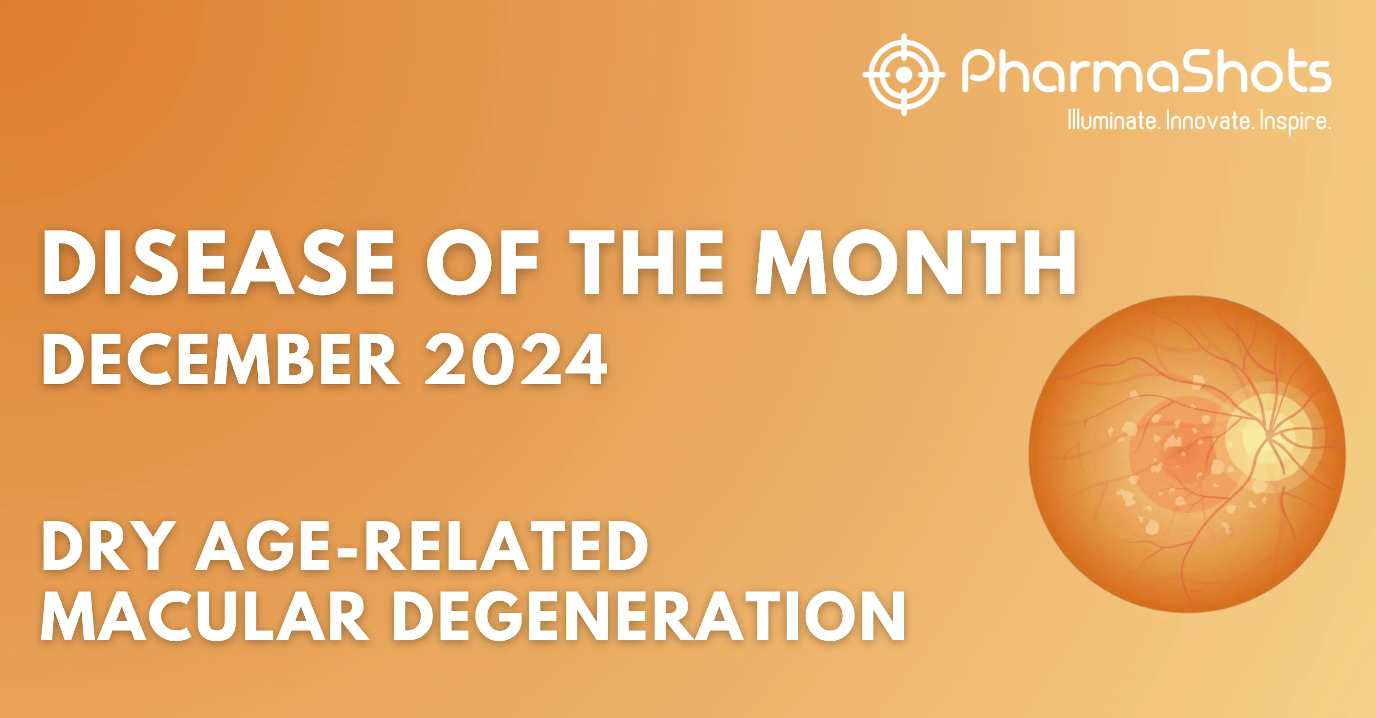 Disease of the Month – Dry AMD