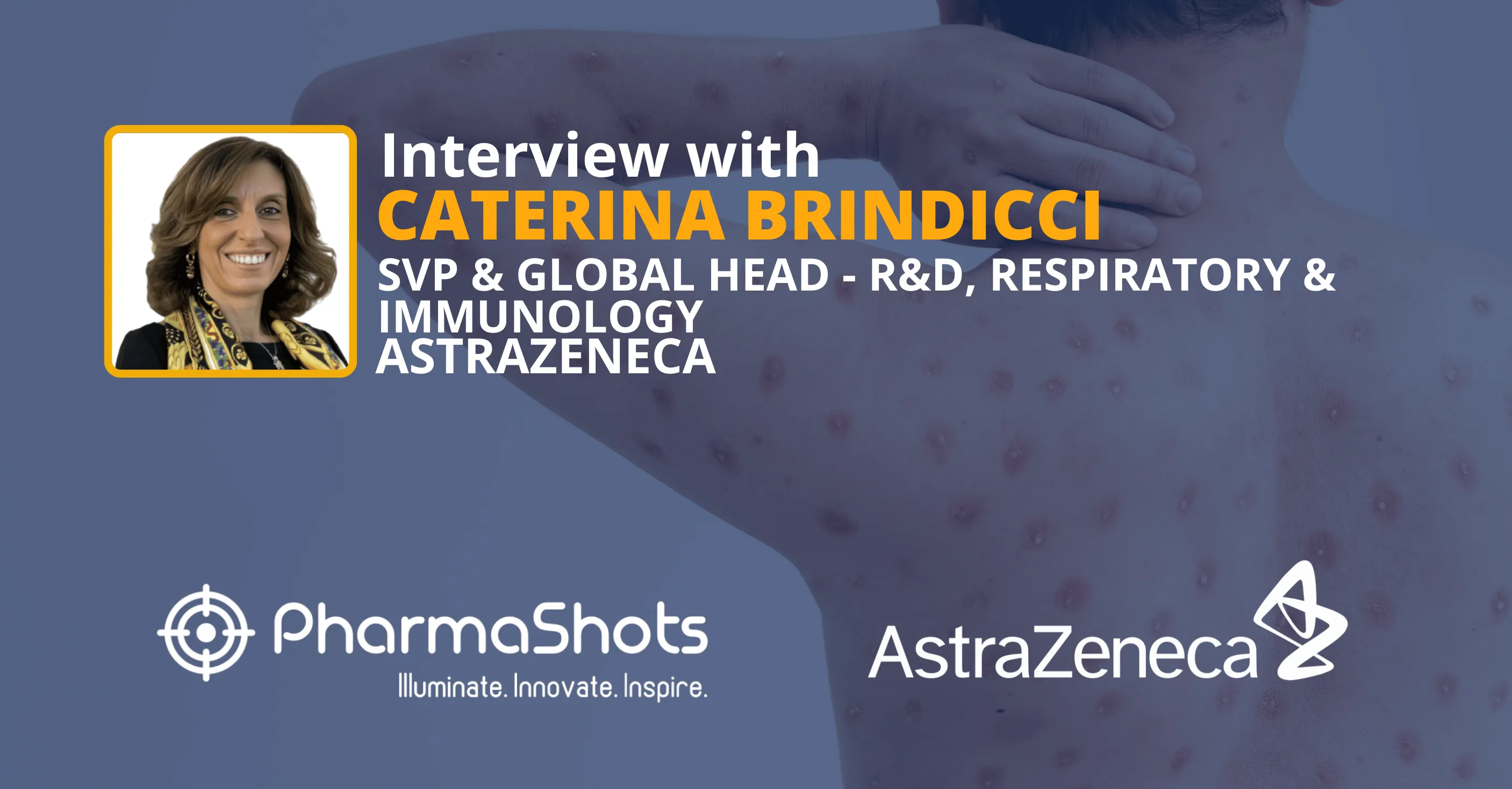 Enhancing Autoimmune Care: Caterina Brindicci from AstraZeneca in a Riveting Conversation with PharmaShots